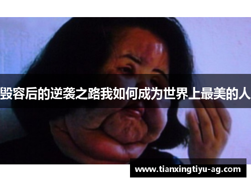 毁容后的逆袭之路我如何成为世界上最美的人